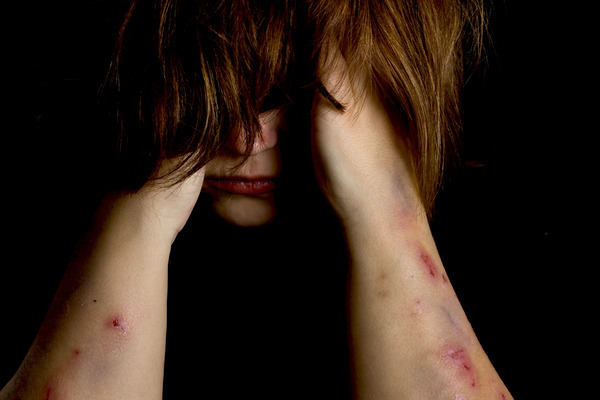 Why are self-harm committed?