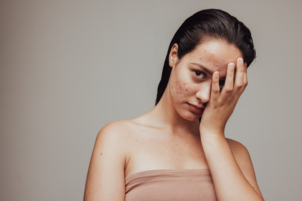 Am I Insecure?: 17 Signs of Being an Insecure Person