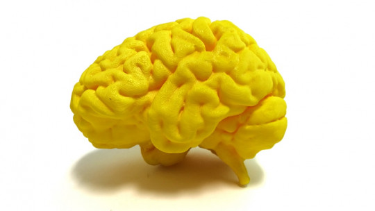 Areas of the brain associated with language