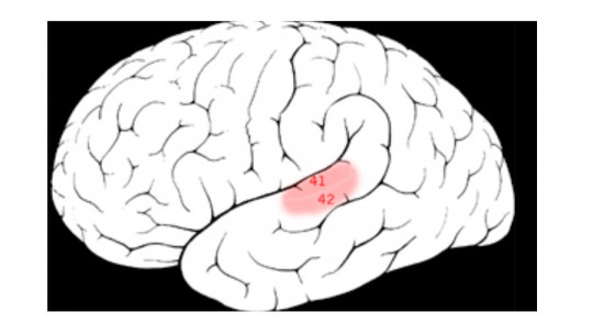 auditory cortex