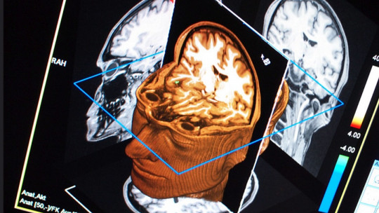 Brain Anti Reward Circuit: What it is and How it Works