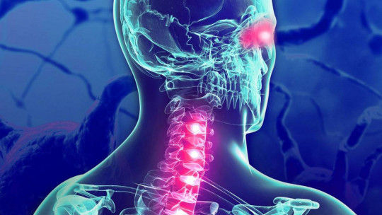 Cognitive impairment due to Multiple Sclerosis