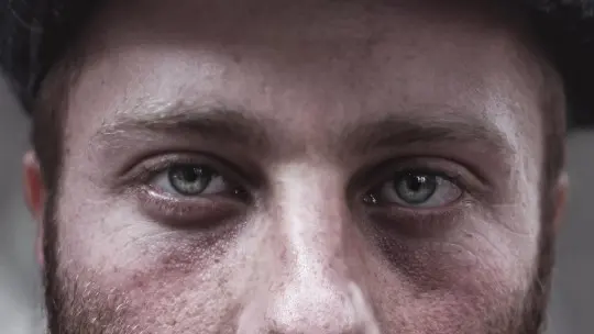 Depersonalization disorder