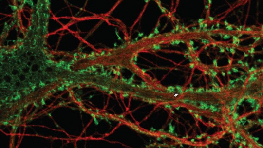 Dopaminergic Neurons: Characteristics and Functions