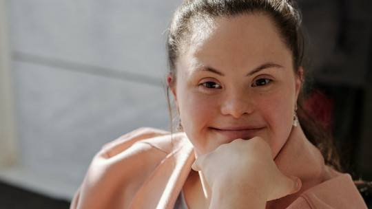 Down Syndrome: What it Is, What Causes It, and Associated