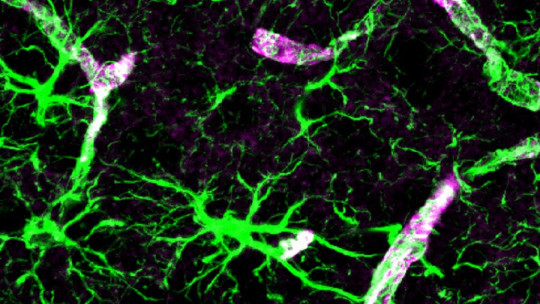 Glymphatic System: What it is and What Functions it Performs