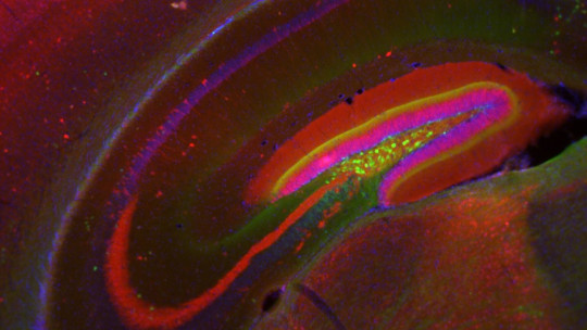 hippocampal formation