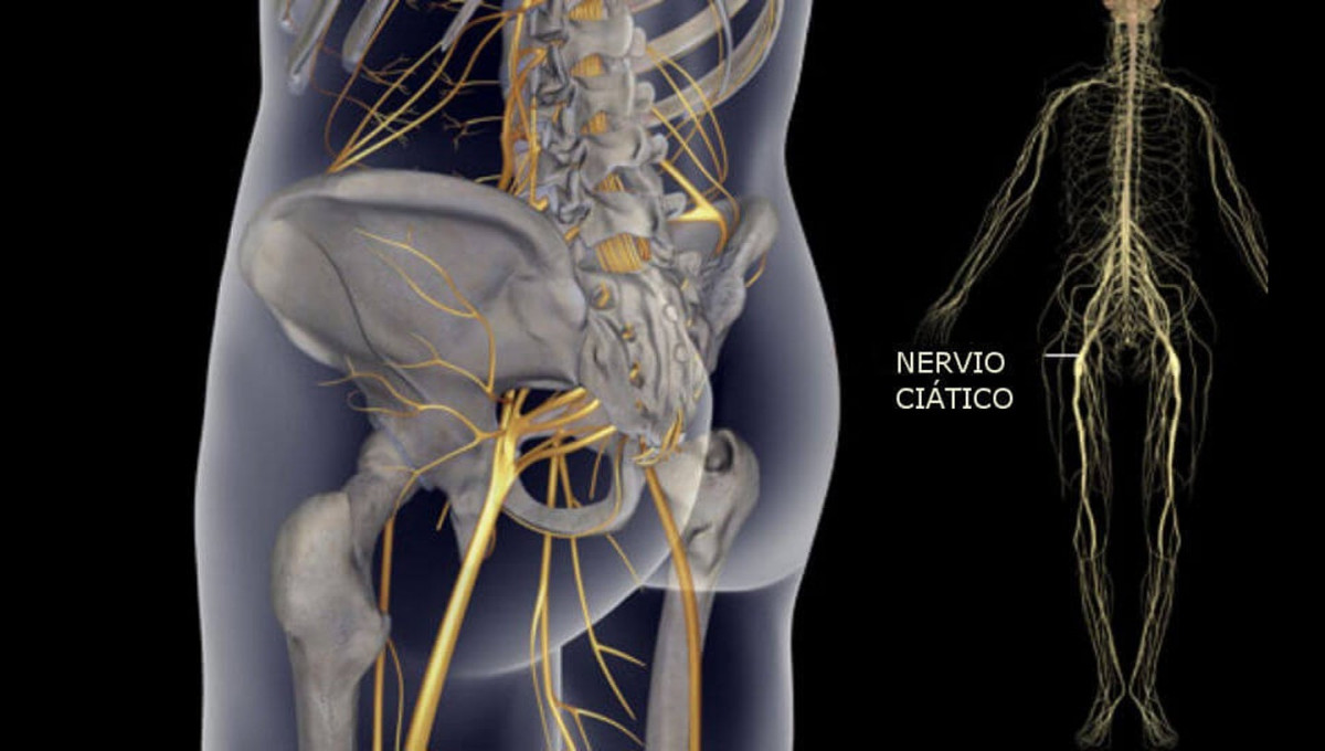 ischial nerve