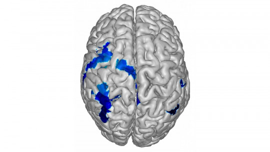 Left cerebral hemisphere