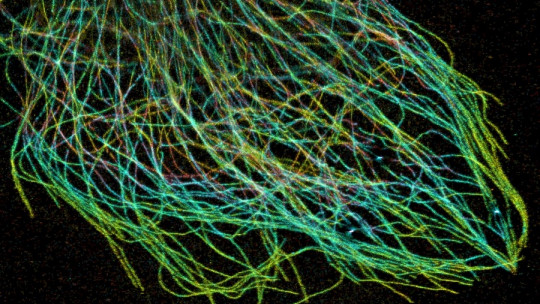 Microtubules: What They Are, Composition, and What They Are for