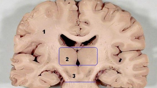 Midbrain: Characteristics, Parts and Functions