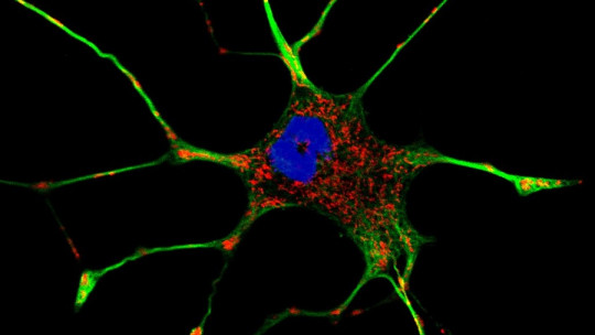 neuron cytoskeleton