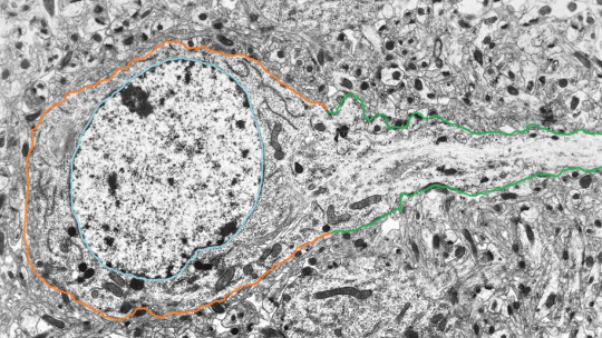 Neuronal Soma or Perikaryon: Parts and Functions