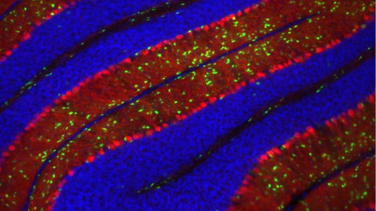 Purkinje Neurons: Their Functions and Characteristics