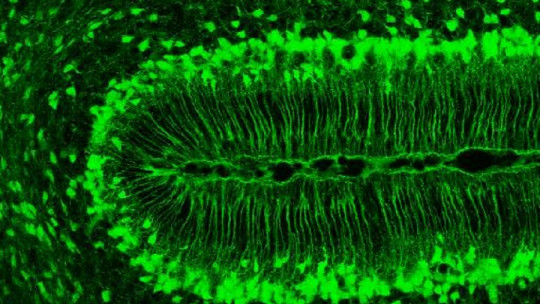 Radial glial cells