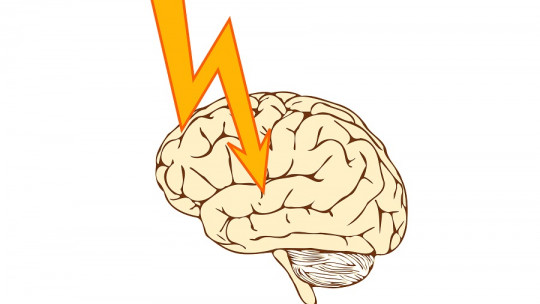 Refractory Epilepsy: Symptoms, Causes and Treatment