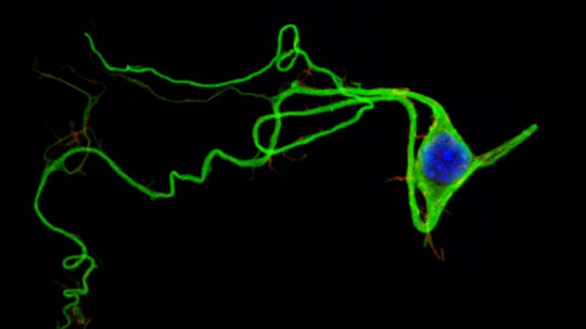 Resting membrane potential