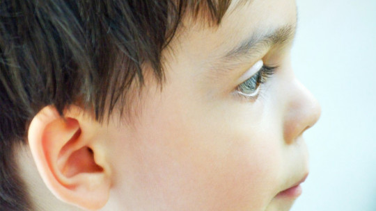 Rubinstein Taybi Syndrome: Causes, Symptoms and Treatment