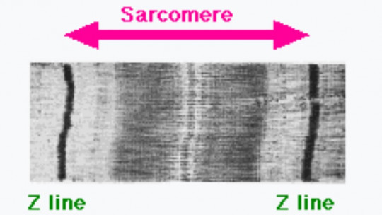 Sarcomere