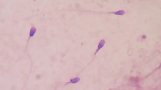 Spermatogenesis: What it is and What Are Its Phases Spermatogenesis: What it is and What Are Its Phases