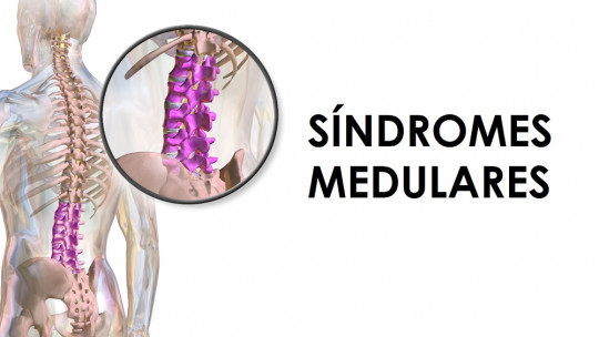 Spinal Cord Syndromes: Types, Causes and Symptoms