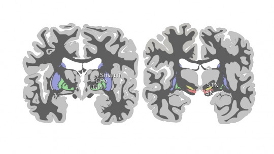 Substantia Nigra: What it Is, Functions and Related Disorders