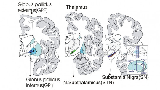 Subthalamus: Parts, Functions and Associated Disorders