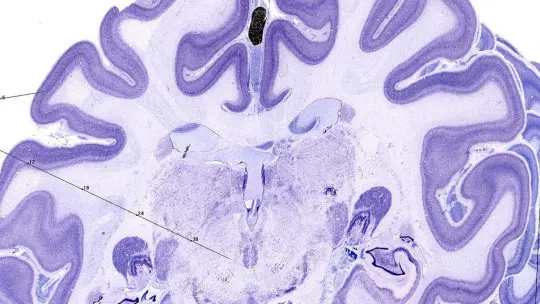 The 3 types of sensory memory iconic echoic and haptic