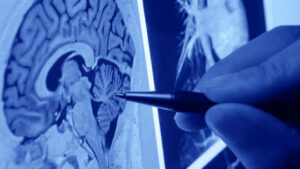 The 8 Types of Neurologists (and What Neurological Pathologies They