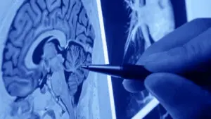 The 8 Types of Neurologists (and What Neurological Pathologies They