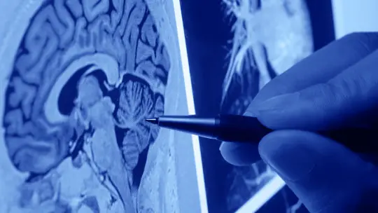 The 8 Types of Neurologists (and What Neurological Pathologies They