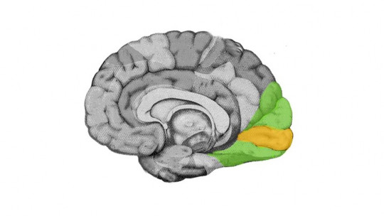 Visual cortex of the brain.