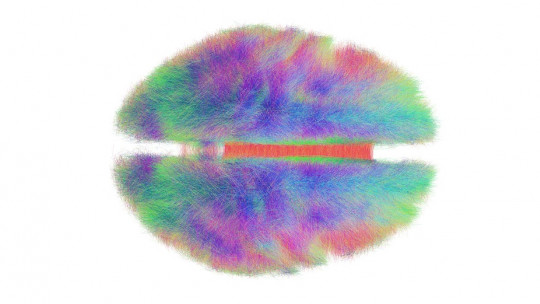 What is a Connectome? the New Maps of the Brain