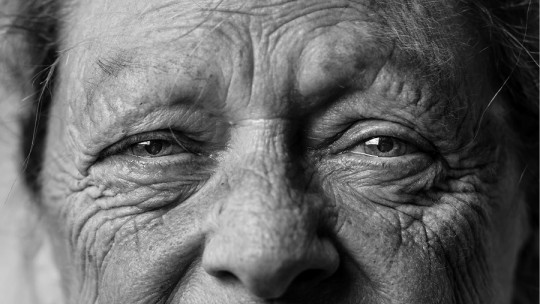 What Life Expectancy Does an Alzheimer's Patient Have?