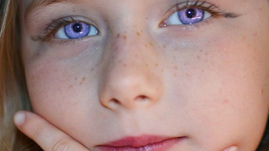 ​alexandria Syndrome: the "rare Condition" of Violet Eyes