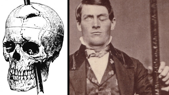 ​the Curious Case of Phineas Gage and the Metal Bar