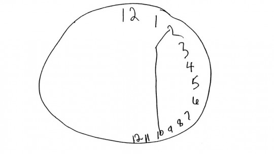 Hemineglect: Patients for Whom the Left Side Does Not Exist