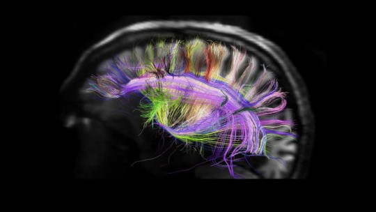 The 7 Types of Neurological Tests