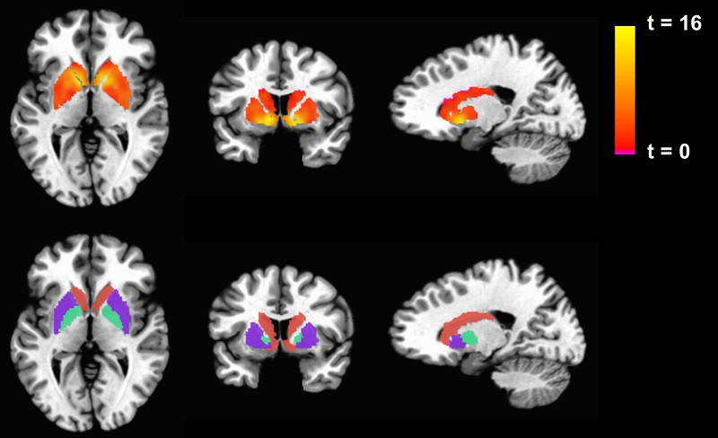 Characteristics of neurocognitive disorders