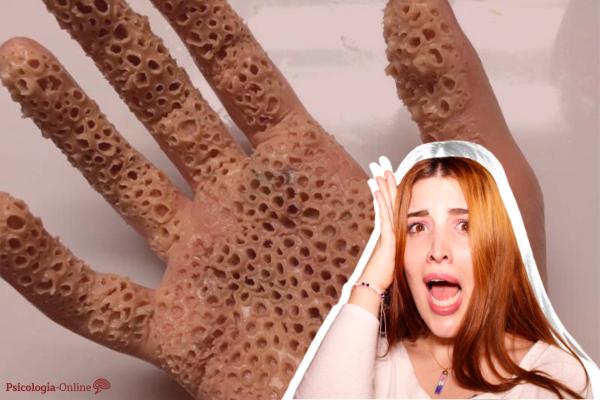 Dermatopathophobia (fear of skin diseases): what it is, symptoms, causes and treatment