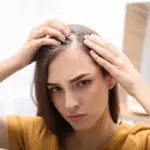 How Alopecia Can Affect Your Self Esteem