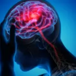 Neurocognitive Disorders: What They Are, Types, Characteristics and Causes