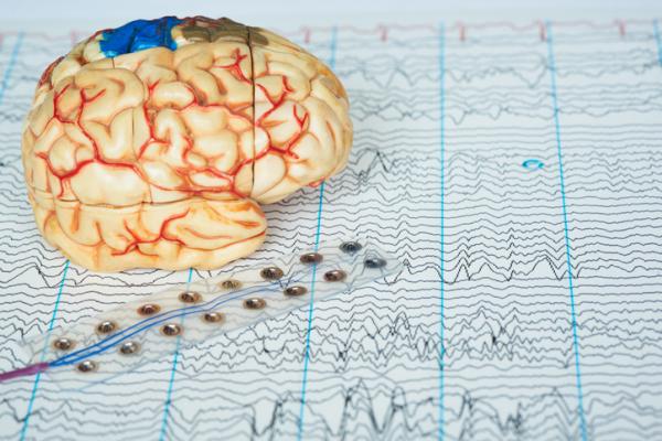 What is electroshock therapy and how does it work?