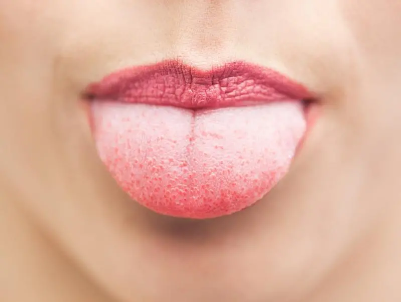 The Tip of the Tongue Phenomenon