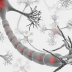 Demyelination and Associated Diseases