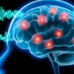 Epilepsy: Definition, Causes, Diagnosis and Treatment