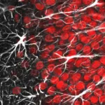 The Role of Glia in Neurological Disease