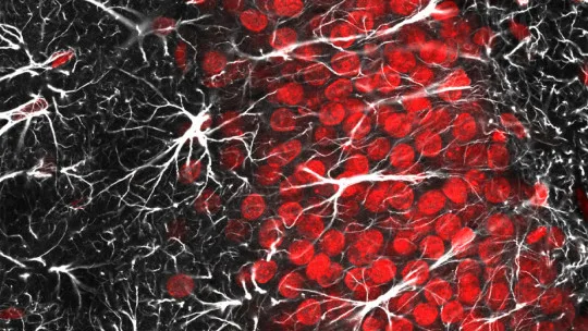 The Role of Glia in Neurological Disease