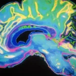 What Are the Areas of the Brain Involved in Creativity?