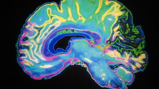 What are the areas of the brain involved in creativity?